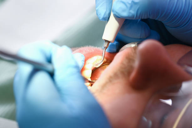 Best Emergency Treatment for Toothache in Riverton, NJ
