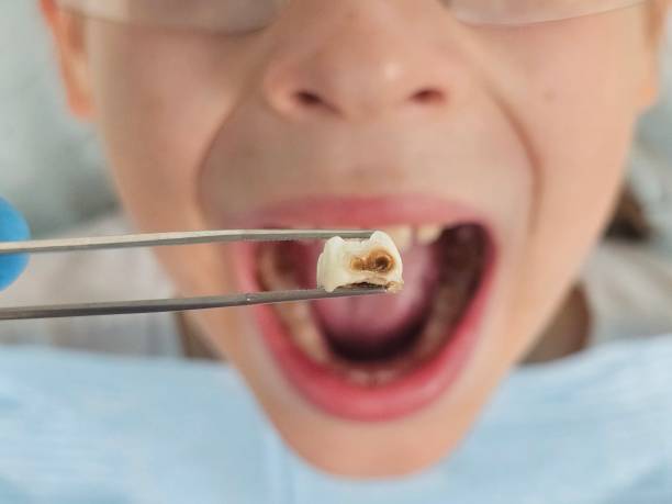 Best Emergency Treatment for Toothache in Riverton, NJ